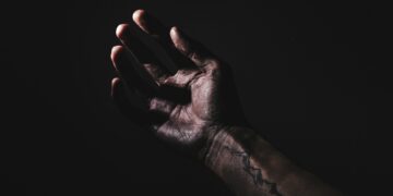 What Condition Is Caused By Prolonged Deficiency Of Thiamine?