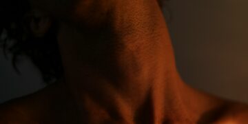 What Condition Involves Low Thyroid Hormone?