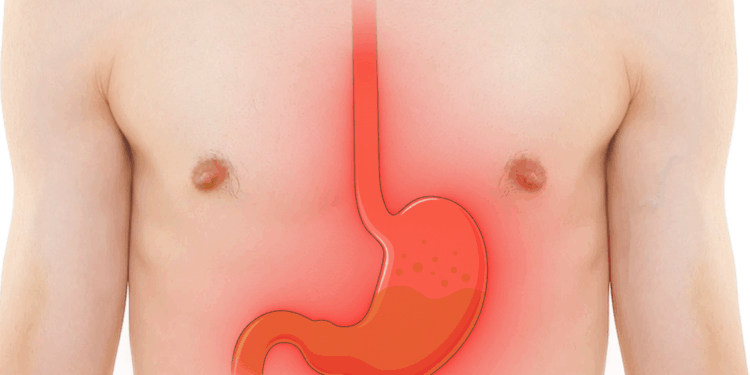 Which Mineral Is Needed To Produce Stomach Acid?