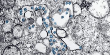 New COVID Strain Dominates A Third Of U.S. Infections