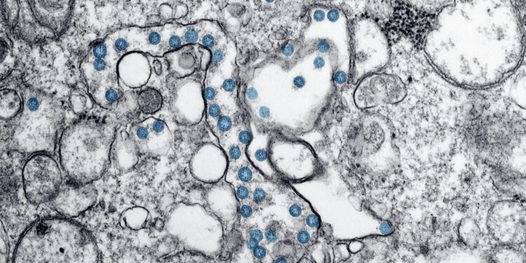 New COVID Strain Dominates A Third Of U.S. Infections