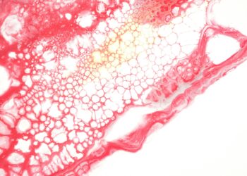 What Amino Acid Helps Produce Nitric Oxide For Vessel Dilation?