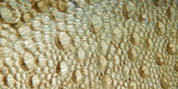 Fish Skin Used To Treat Life-Threatening Infant Wound