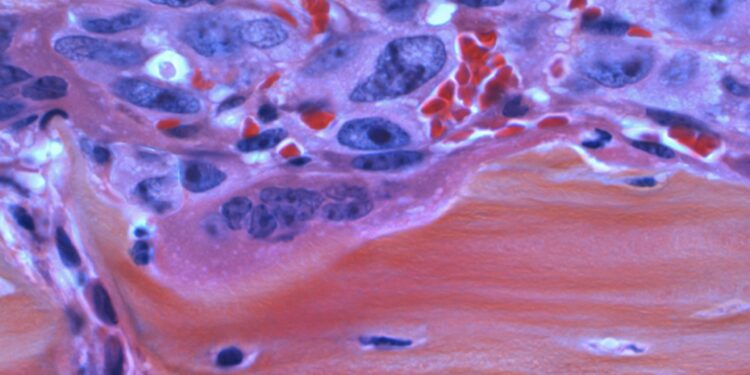 Detect Cancer Before It Strikes