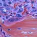 Detect Cancer Before It Strikes